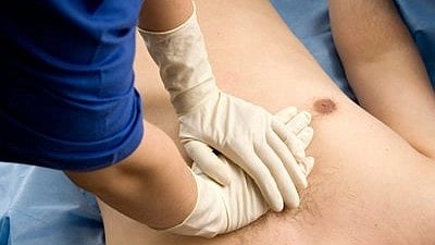 World Stroke Day 2026: Post-Covid Stroke Cases Among Young Adults Rise 10–15 Per Cent; Fewer Than 5 Pc Reach Hospitals In Time