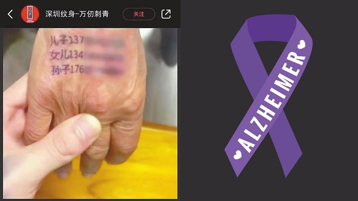 Alzheimer Care: Chinese Parlour Inks Patients With Info-Based Tattoo; Netizens React After Idea Goes Viral On Social Media 