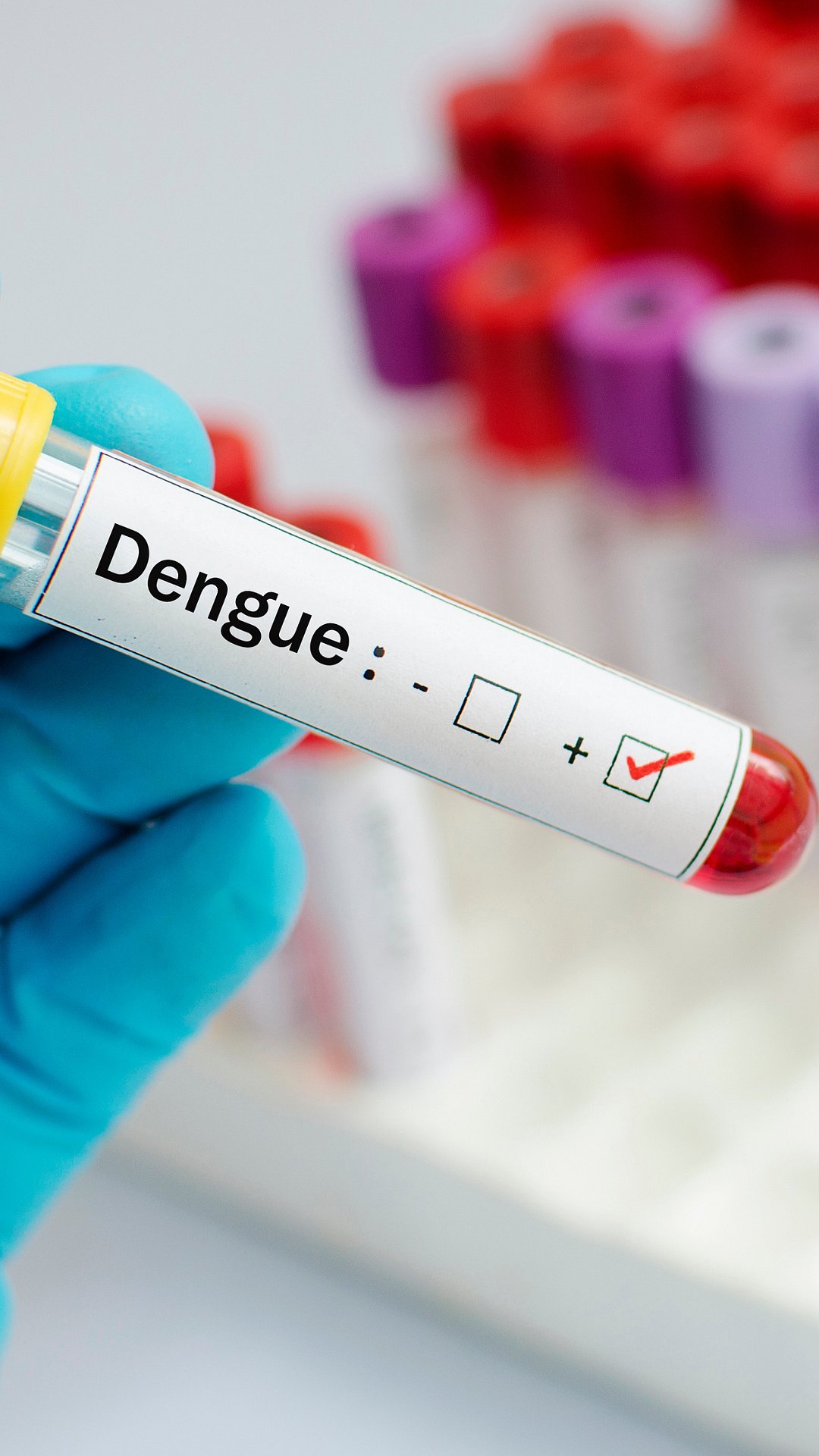 Surge In Dengue Cases Amidst Monsoon: Ways To Protect Yourself From Mosquito Bites