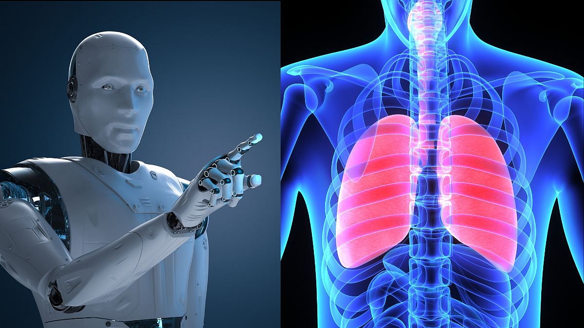 Representative image | Canva