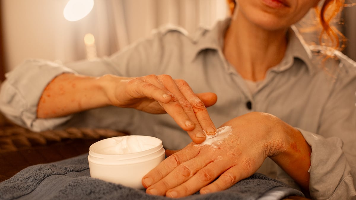 Dry Skin In Monsoon: These Simple Tips Can Help You Fix It