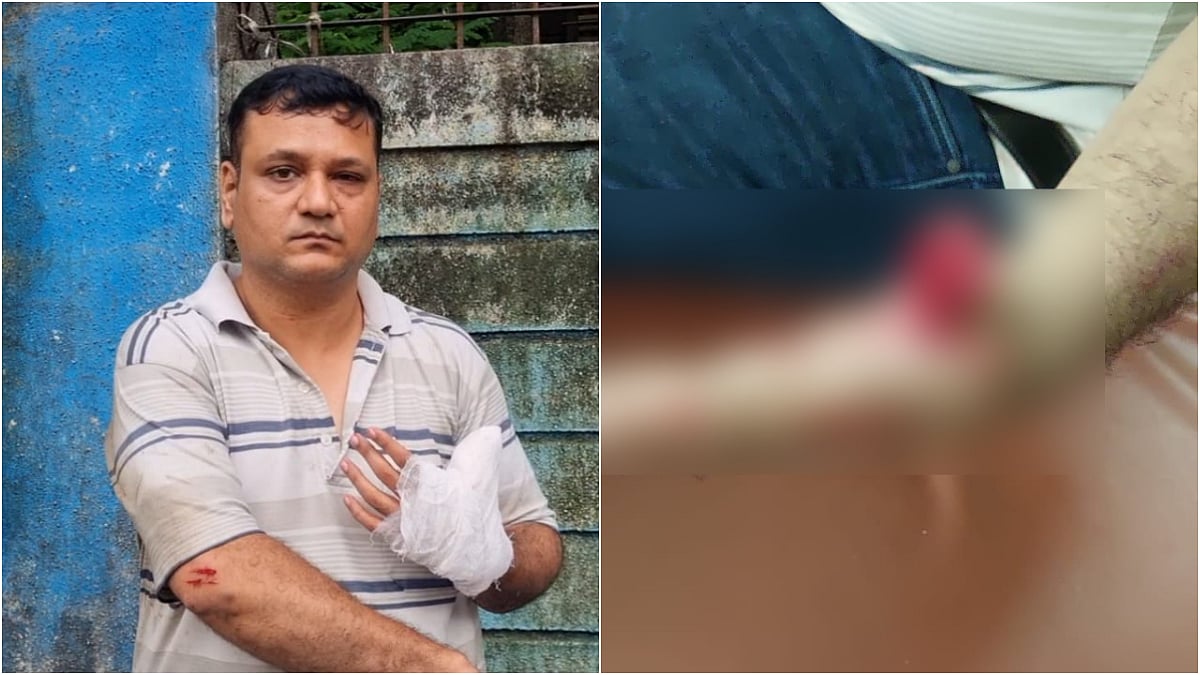 Mumbai: Police Issue Notice To 67-Year-Old Society Chairman For Allegedly Biting Off Member's Thumb During Society Meeting In Dahisar | 