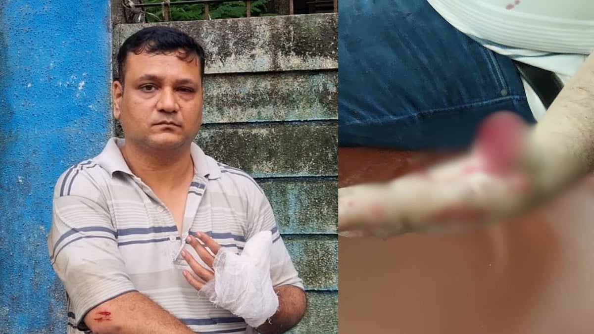 Victim Aditya Desai alleged the chairman cut off his thumb | FPJ