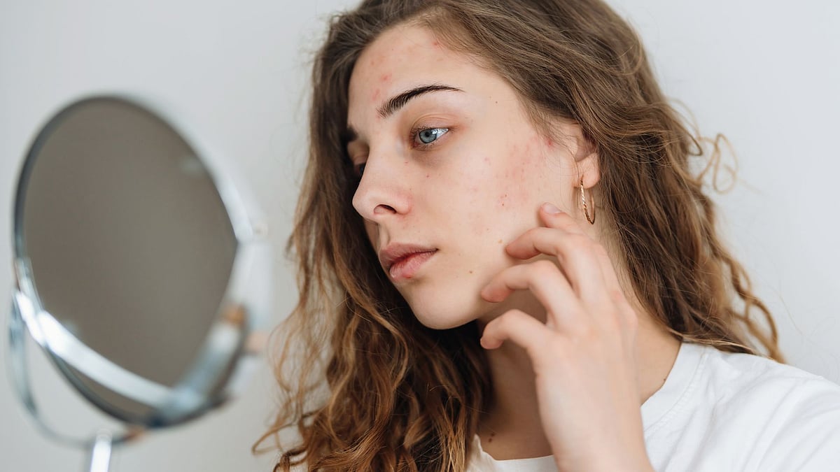 How Divya Psorogrit Aids In Managing Effects Of Psoriasis As Per Ayurveda