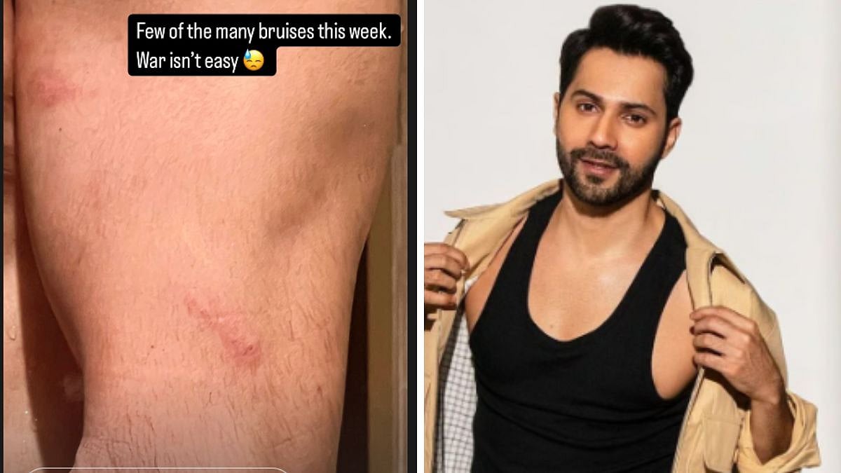 'War Isn't Easy,' Says Varun Dhawan As He Showcases Bruises Sustained While Filming Border 2