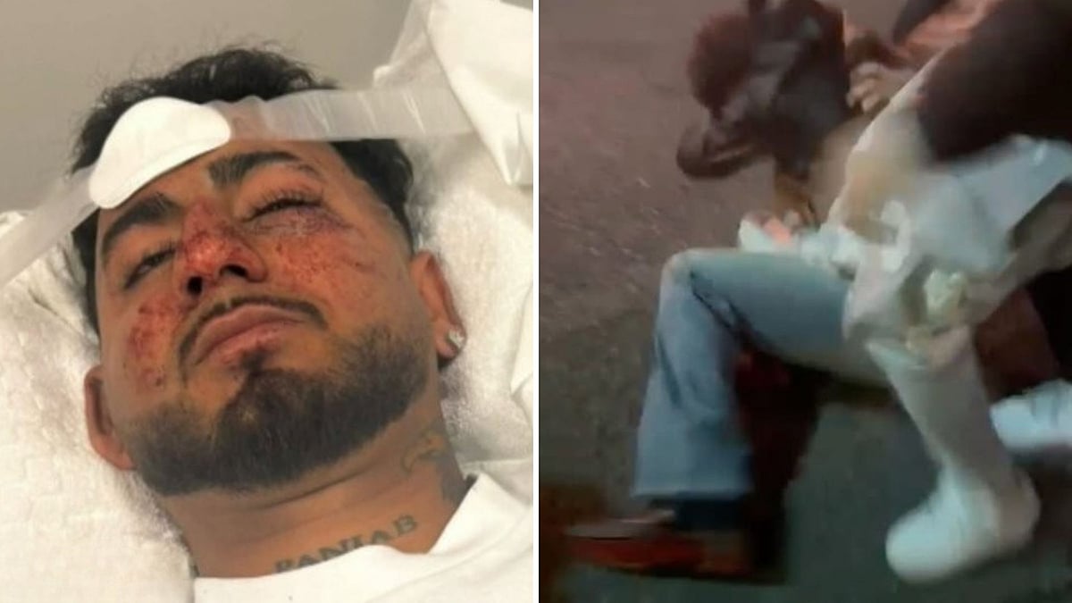 Who Is Charanpreet Singh? Indian Man Brutally Assaulted In Australia, Told To 'F*** Off' Before Being Left Unconscious | X/@johnitas2