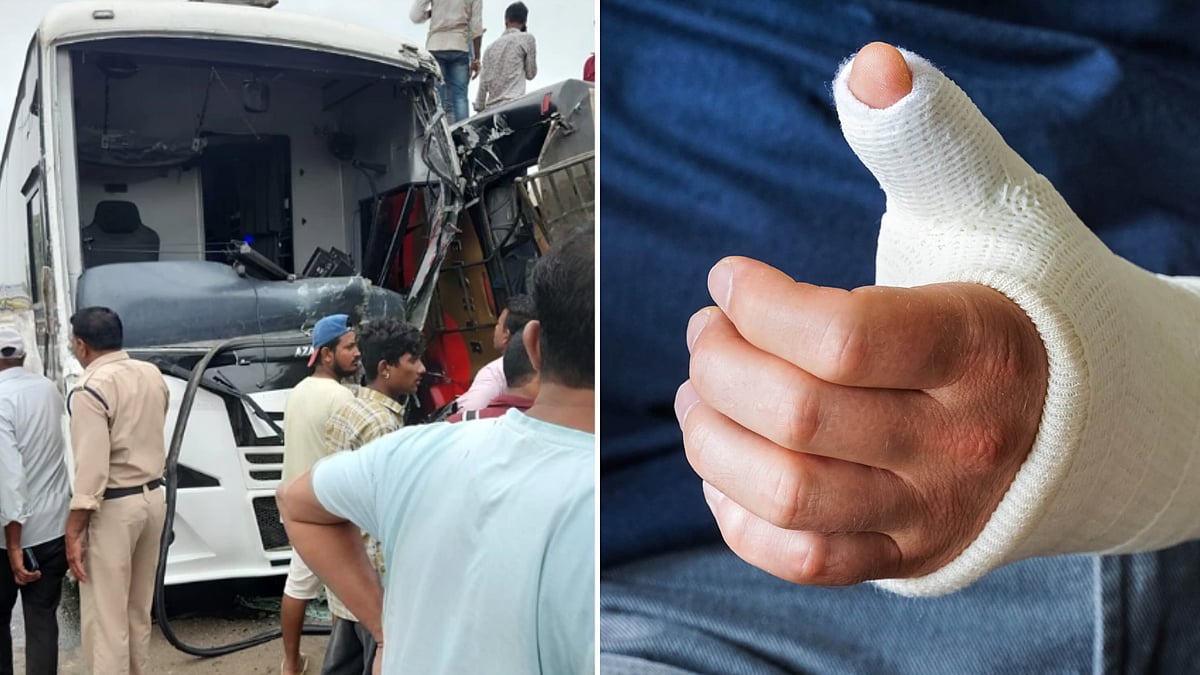 MP: 2 Buses Collide On Bhopal-Indore Highway; One Sustains Fracture, Several Injured |