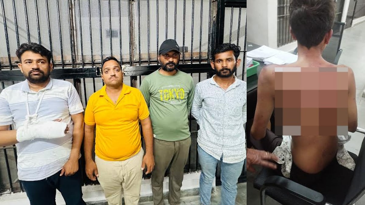 Madhya Pradesh: 18-Year-Old Kidnapped, Beaten Black & Blue Over Trivial Issue In Mandleshwar