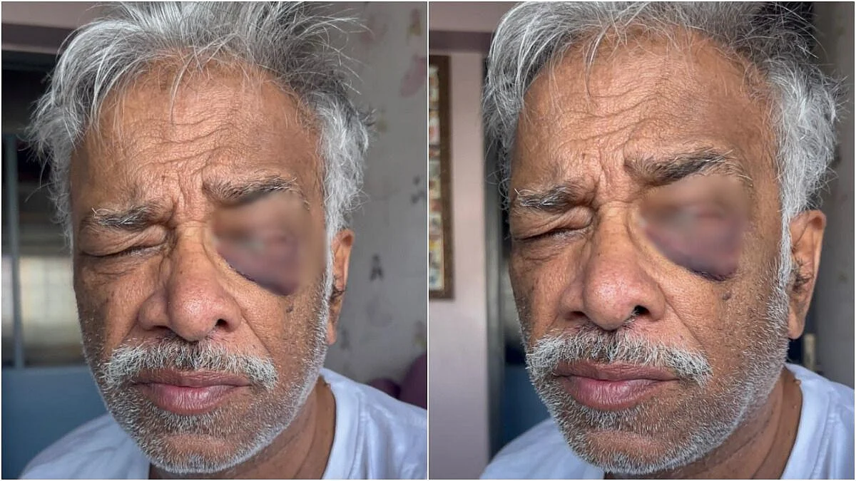 Patient Rajendra Gupta (67) from Koparkhairane