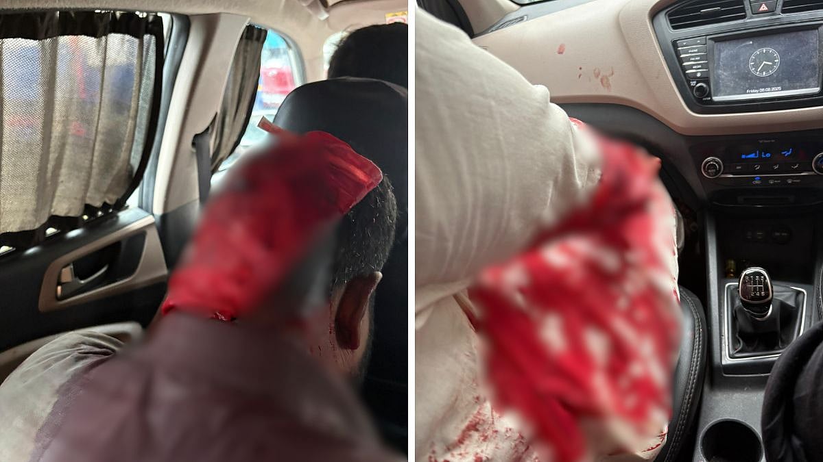 Clash Over Garage Dispute in Taloja