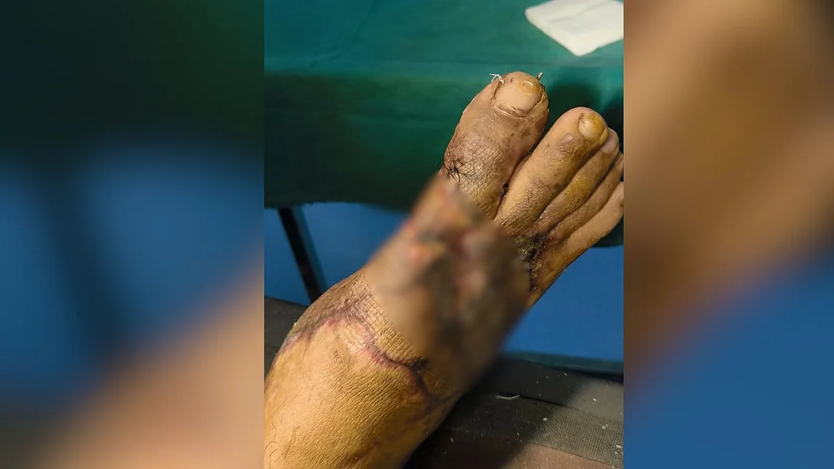The condition of the patient's leg
