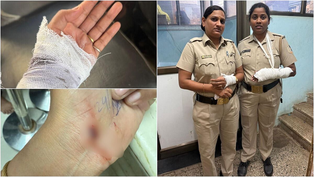 Mumbai Crime: 2 Women Security Guards Brutally Attacked By Drug Addicts At Ghatkopar's Rajawadi Hospital, Case Registered