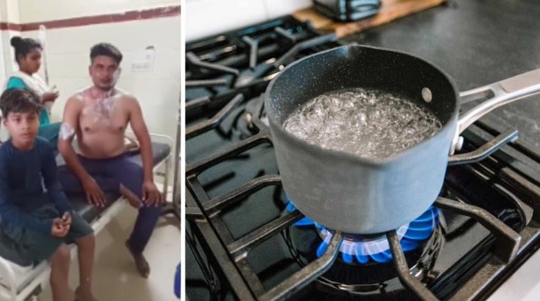 Shocker! Woman Throws Boiling Water On Husband For Sleeping Till Late In MP's Gwalior