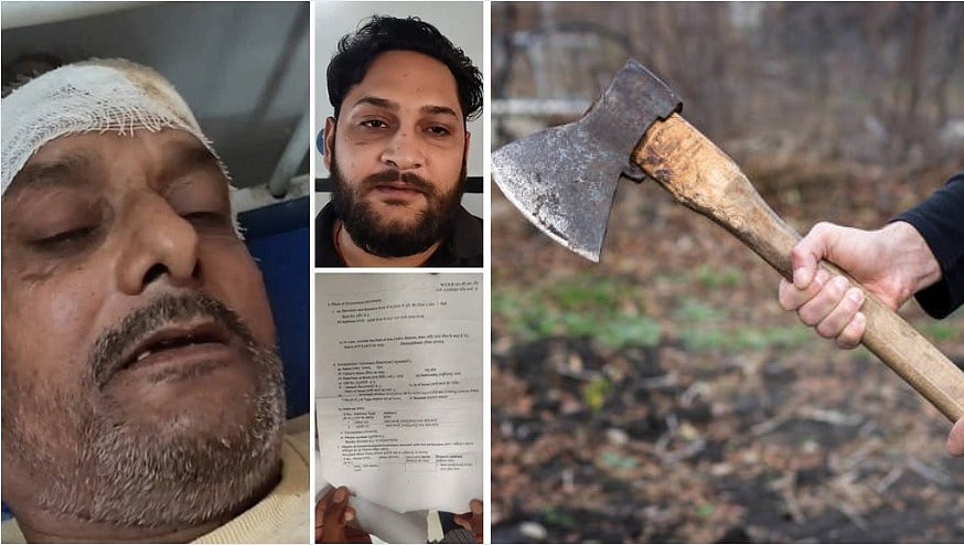 MP News: Diwali Celebration Turns Painful As Man Attacked With Axe After Requesting ₹20K Old Debt...