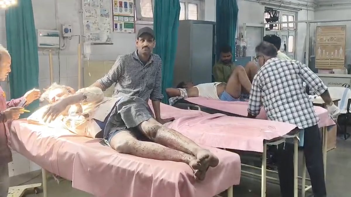 MP News: Firecracker Experiment Turns Tragic In Shivpuri, 2 Suffer Severe Burns