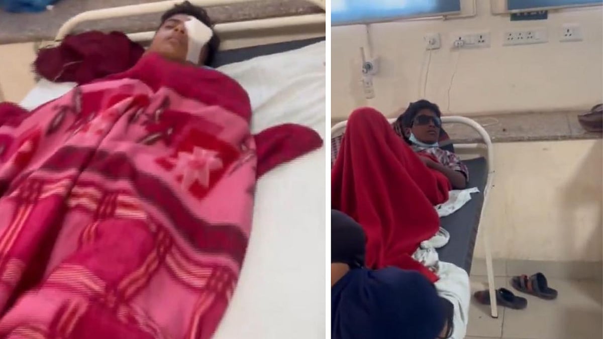 MP Shocker! 14 Children Lose Vision After Using Carbide Guns As Diwali Firecracker