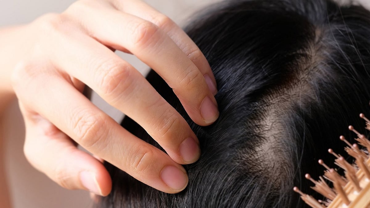 Taiwan's National University Develops A Revolutionary Hair Serum That Regrows Hair Within Three Weeks; Here's To Find Details