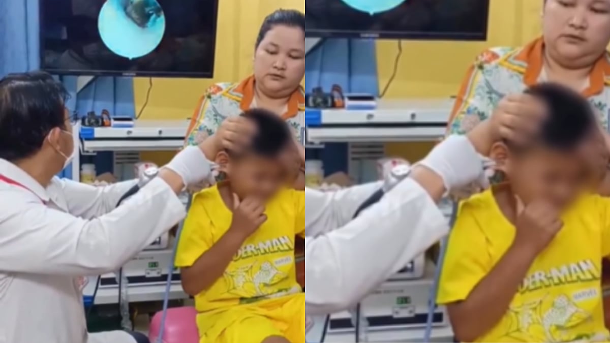 Doctor Pulls Out Live Cockroach From Boy’s Ear In Cambodia; Terrifying Video Stuns Netizens, 'Childhood Fear Unlocked'