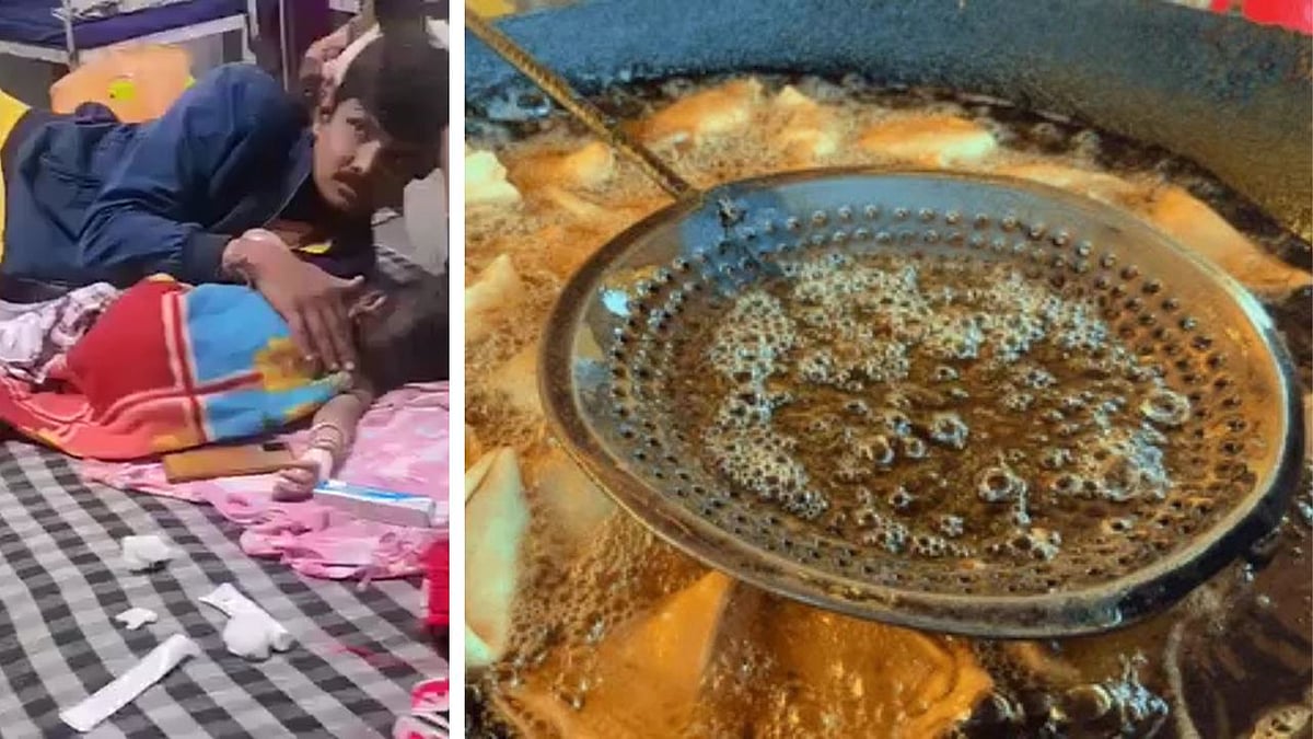 MP News: Toddler Falls Into Hot Samosa Pot; Granny Dips Hands In Boiling Oil To Rescue Child In...