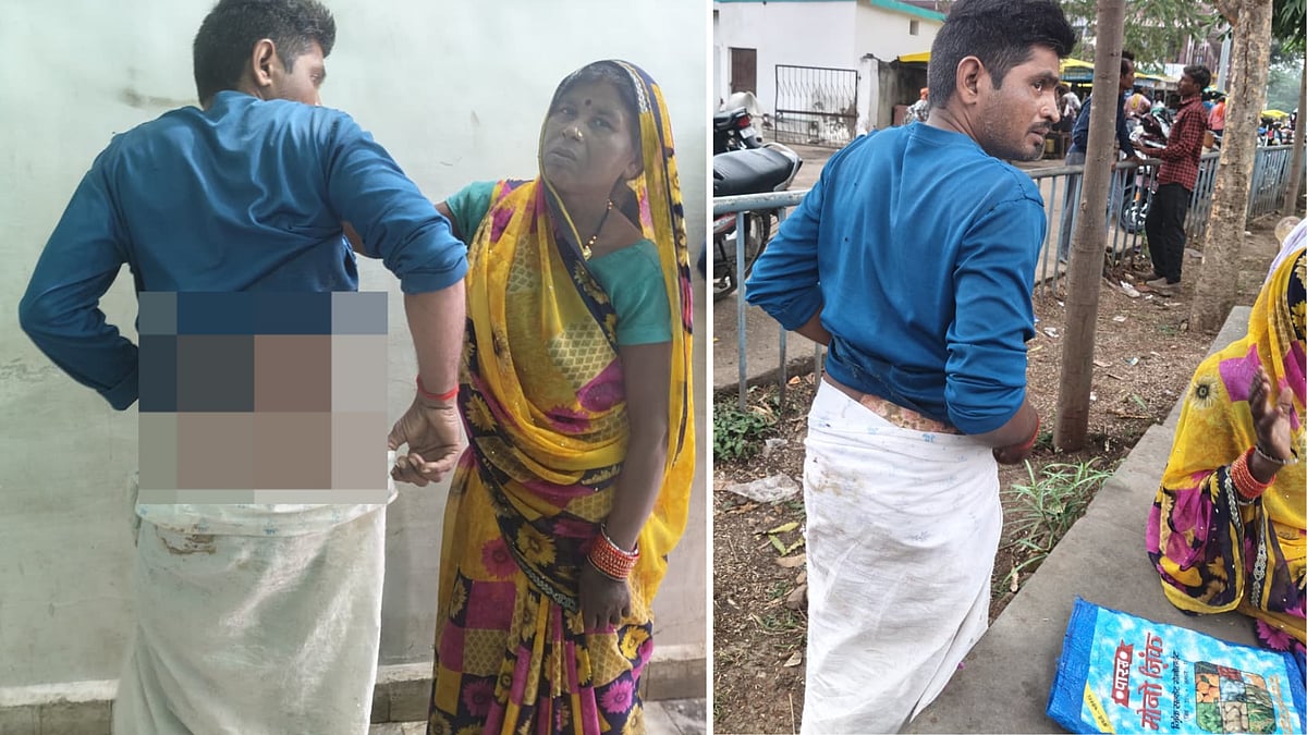 MP News: Dalit Youth Dragged To Garbage Bin, Set Afire In Sagar; Mom Douse Flames, Rush Him TO...