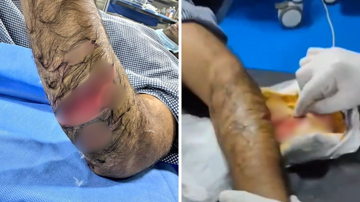 'Where He Stay Madam': Cyberabad Police’s Vague Reply After Activist Alleges Man Got 38 Stitches In Knife Attack By Estranged Wife, Deleted Later 