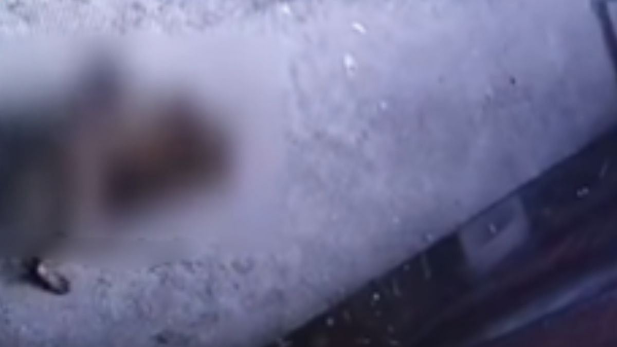 Thane Shocker: 2-Year-Old Girl Attacked By Stray Dog; Shiv Sena UBT Leader Warns TMC After Disturbing CCTV Footage Surfaces 