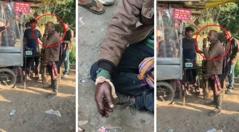 MP News: Mentally-Challenged Man Spotted Playing With Baby Cobra In Jabalpur Despite Being Bitten...