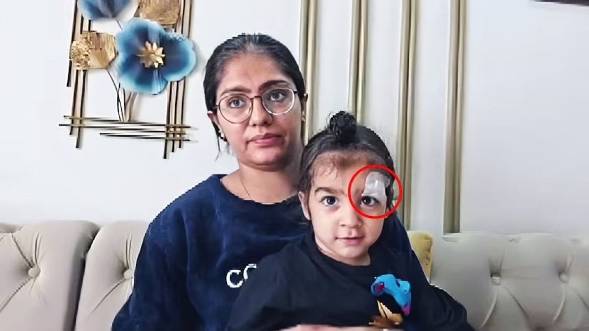 UP Shocker: Doctor Bandages Toddler’s Wound With Fevikwik In Meerut; Probe Launched