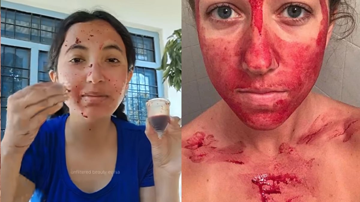 What Is 'Menstrual Masking'? This DIY Skincare Regimen With 'Period Blood' Has Left Internet Disgusted; But Here's The Truth 