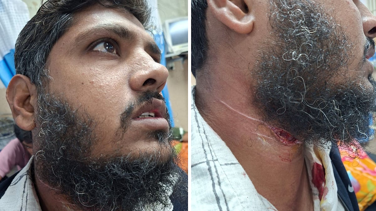 Indore Chinese Manjha Menace: Phone Call Saves Man’s Life