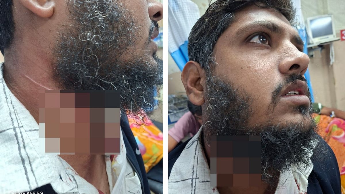 Indore Chinese Manjha Menace: Phone Call Saves Man’s Life