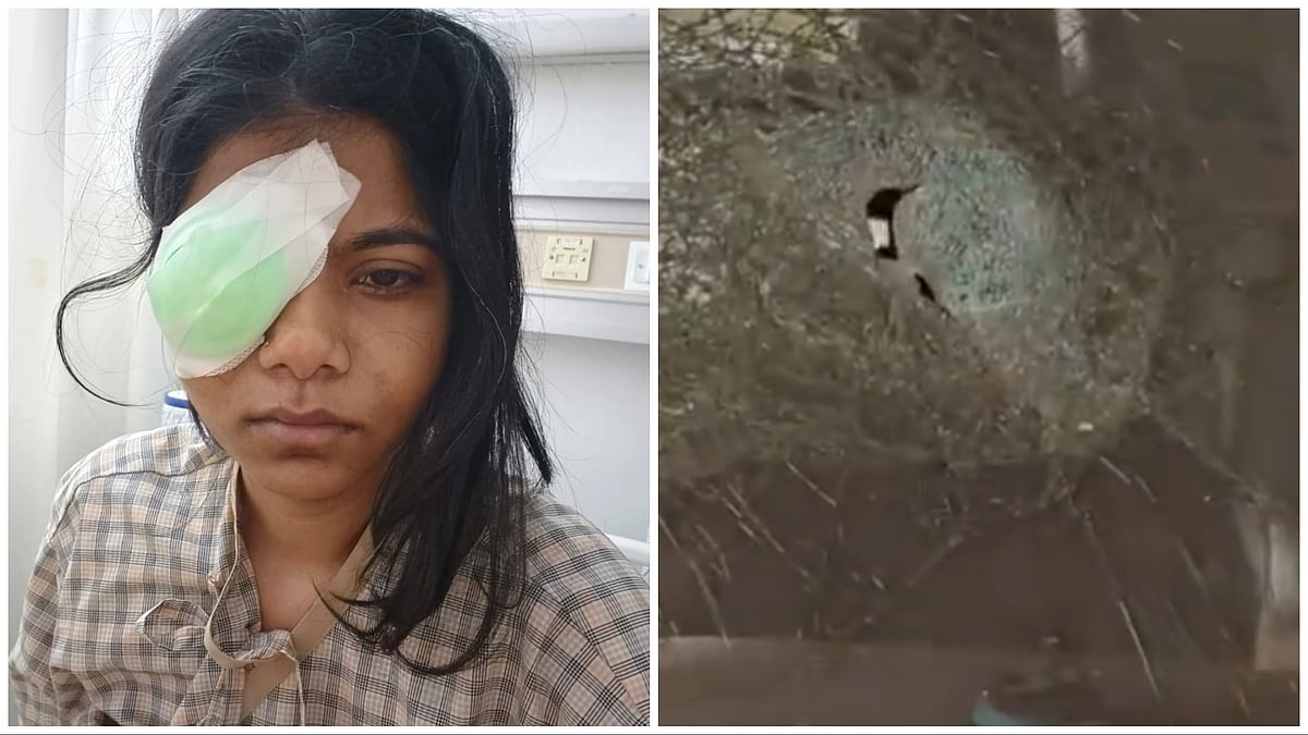 'In Darindo Ne Aankh Phod Di': Mumbai-Based HR Woman Severely Injured In Pune Road Rage Case | VIDEO