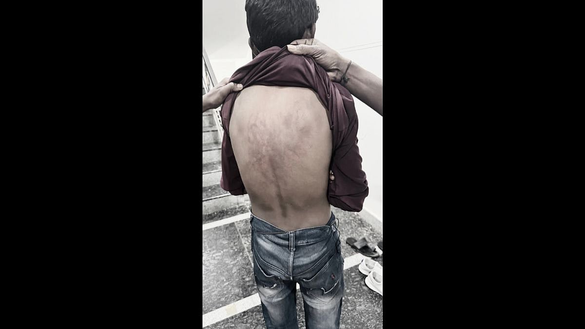 Hyderabad School Shock: Principal Orders Class 10 Students To Beat Class 7 Boy, Probe Launched 