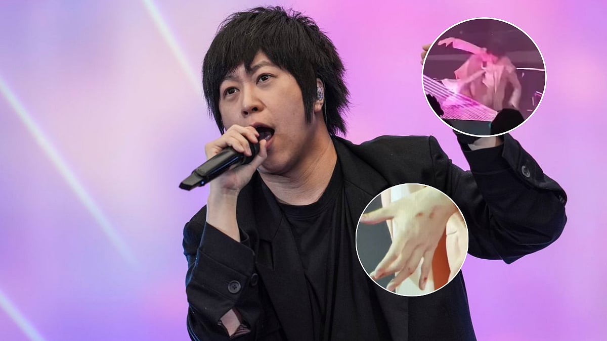 Mayday's Ashin Falls Off Stage During F3 Reunion Shanghai Show, Suffers Scrapes & Bleeding On Hand And Knuckles—VIDEO 