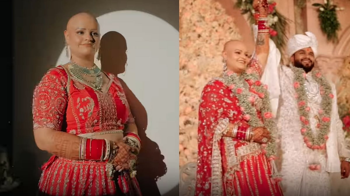 Indian Bride Walks Bald At Her Own Wedding: Owns Her Condition & Rejects Wigs; Watch Viral Video 