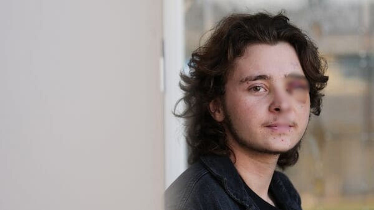 'Blind For Life…': 21-Year-Old Permanently Loses Vision After 'Less-Lethal' Round Fired By Federal...