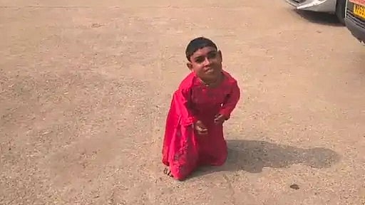 MP News: 20-Year-Old Woman, Only 2 Feet Tall Seeks Financial Aid From Collector For Spinal Surgery...