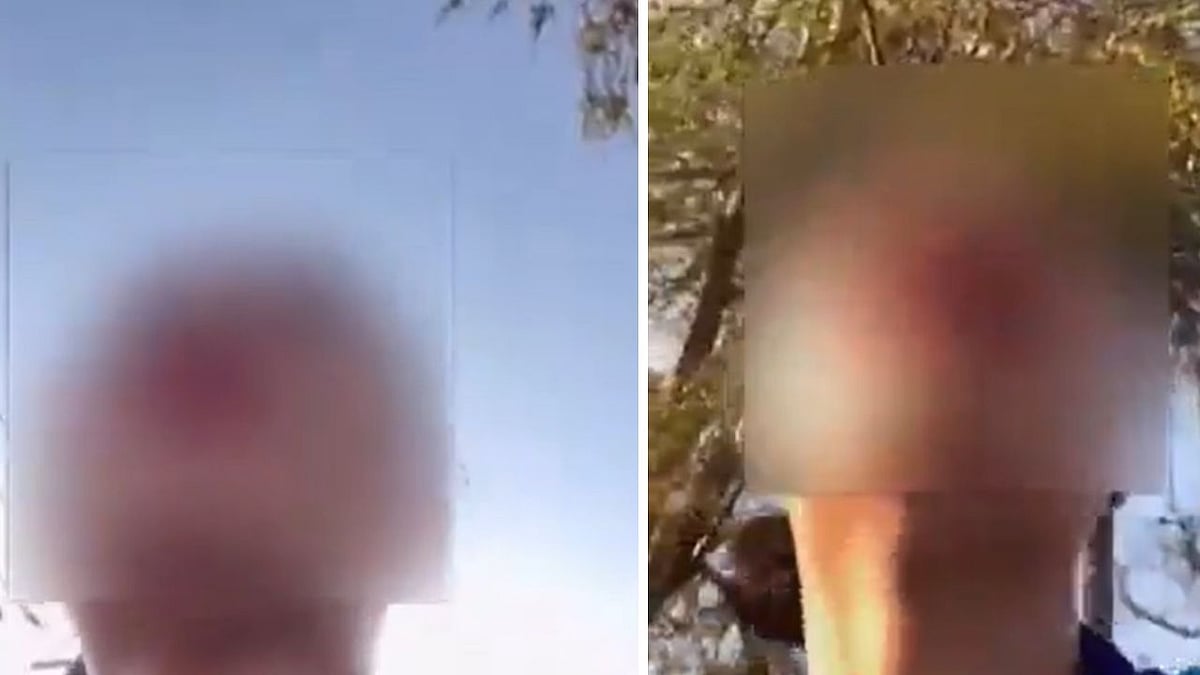 'Help! Help! Bol Rahi Hoon, Koi Nahi Sunn Raha': Woman Alleges Naked Man In Car Followed Her On...