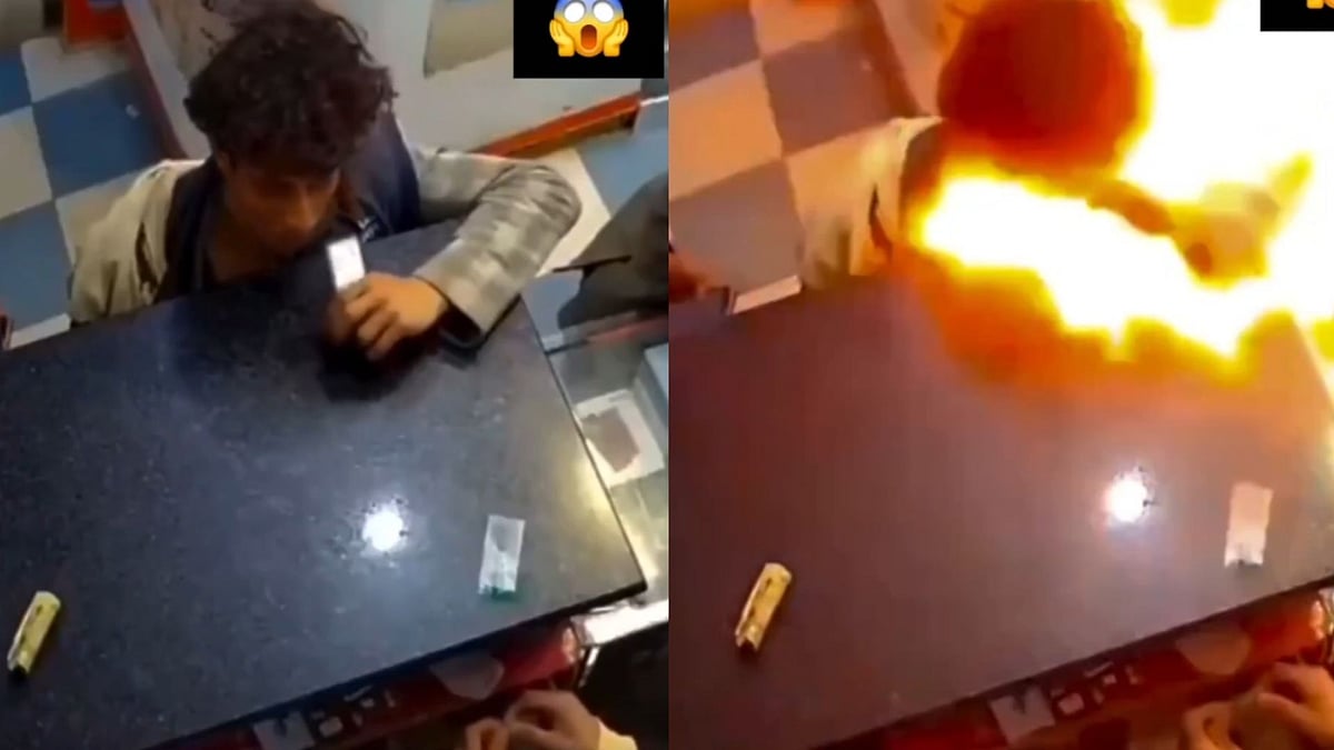 'Not Shocking - Stupid': Lithium Phone Battery Explodes Inside Boy's Mouth After He Chews It; Scary CCTV Footage Go Viral 