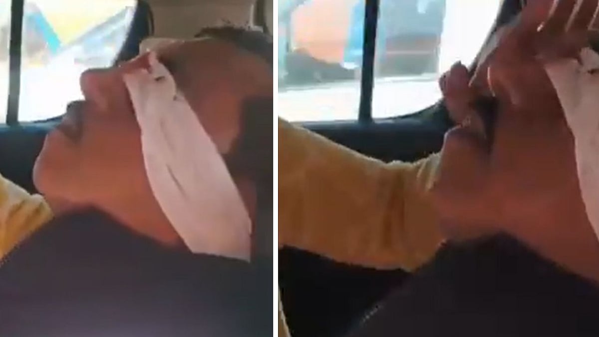 UP: Shocking Video Shows Chinese Manjha Severing Elderly Man’s Nose On Busy Lucknow Road; 5th...