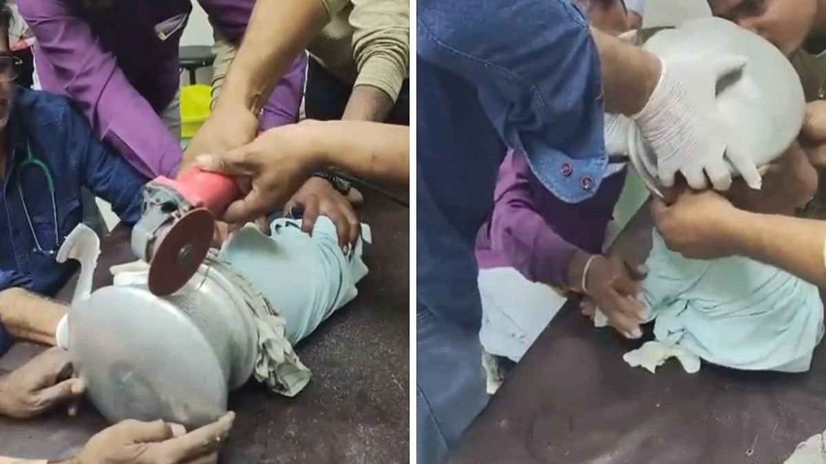Jalgaon Horror Averted: Doctors, Plumber Save 3.5-Year-Old Child After Head Gets Stuck In Aluminium...