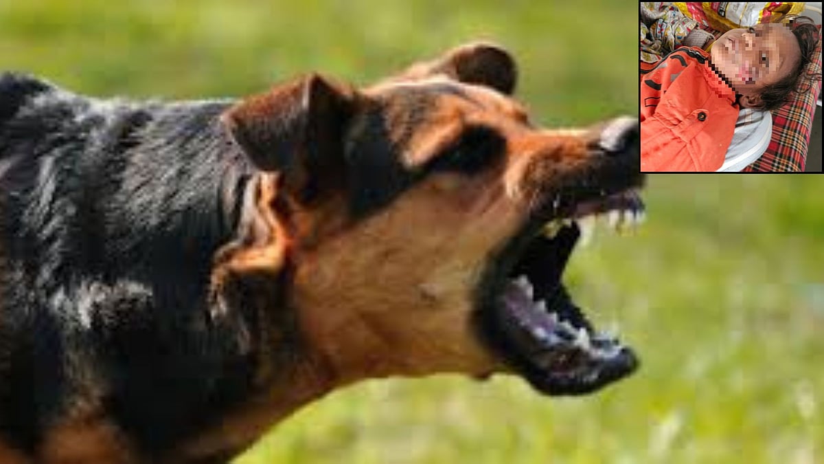 MP News: Stray Dog Brutally Attacks 4-Year-Old In Chhatarpur; Held His Head In Jaw & Dragged Him On...