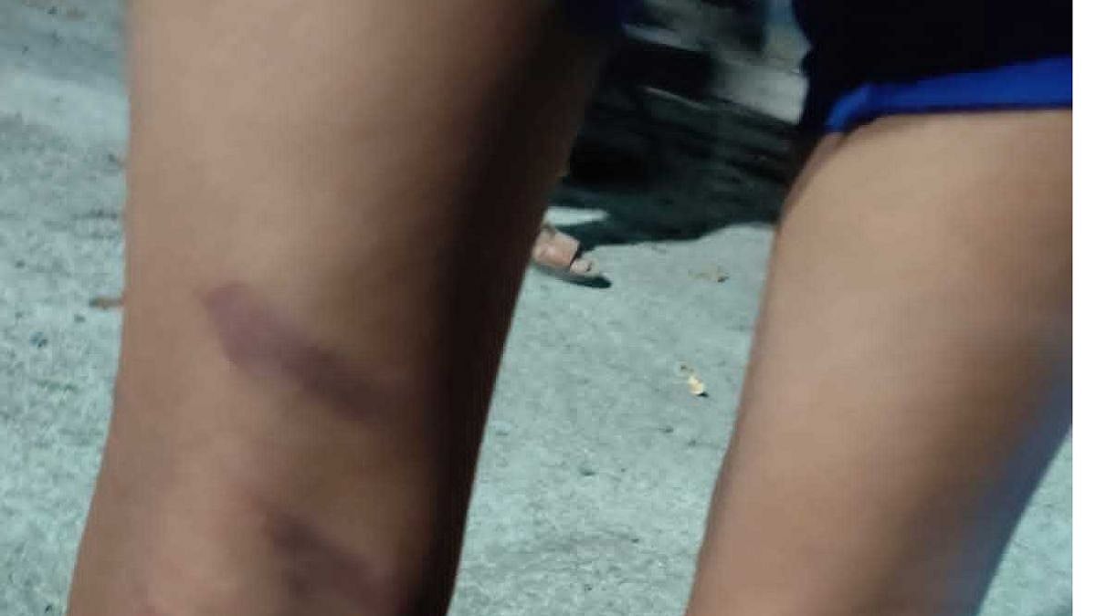 School Teacher Arrested For Thrashing 32 Students With Bamboo Stick For Damaging His Motorcycle In Latur 