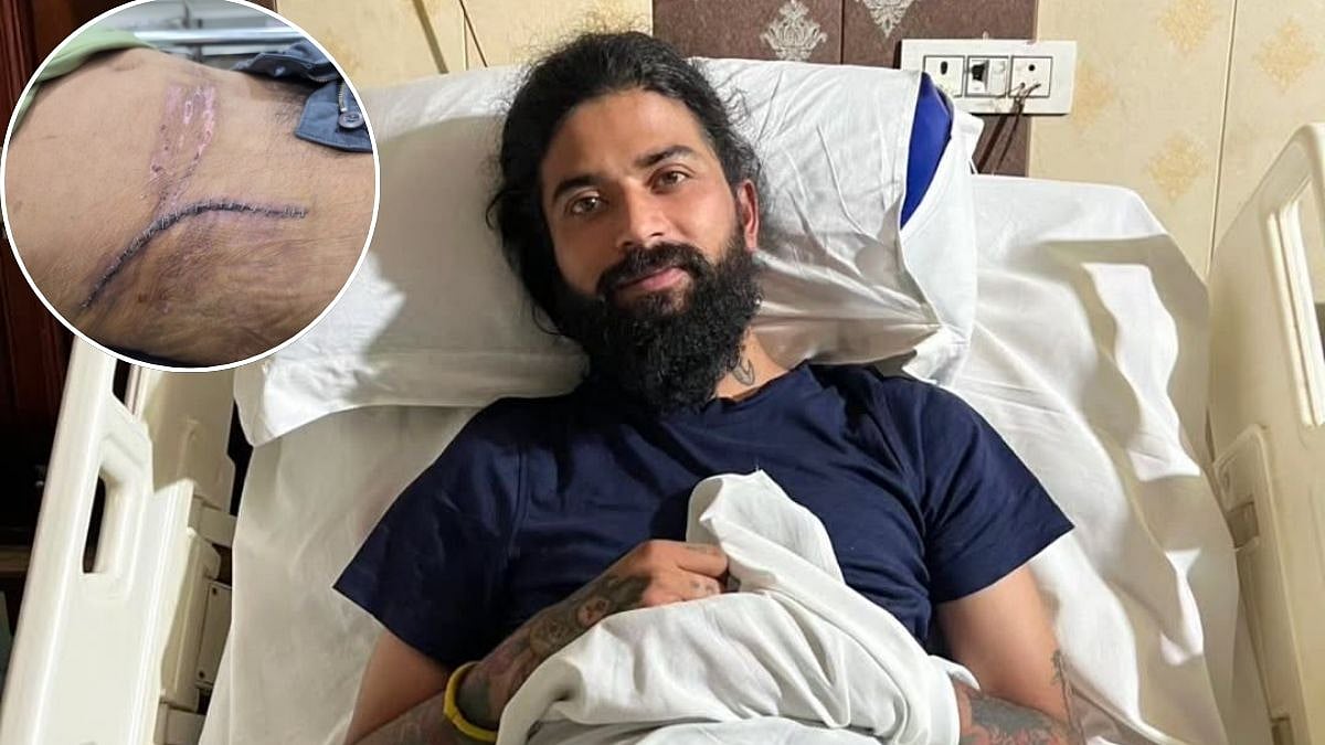 Anurag Dobhal AKA UK07 Rider Shows Injury Scars, Says 'New Zindagi Ki Shuruwaat Dekhoge?' After Surviving Suicide Attempt