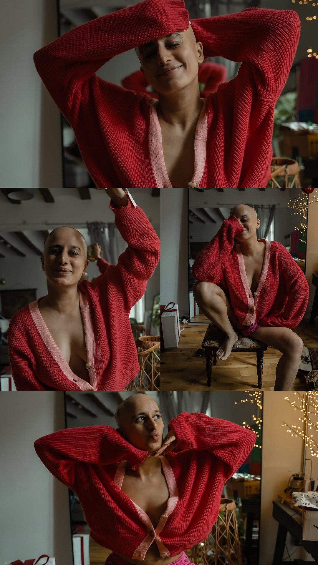 'It's Nerve Wrecking And You Are Scared': Saloni Chopra's Struggle With Alopecia; Know What Is The Condition That She Is Suffering From