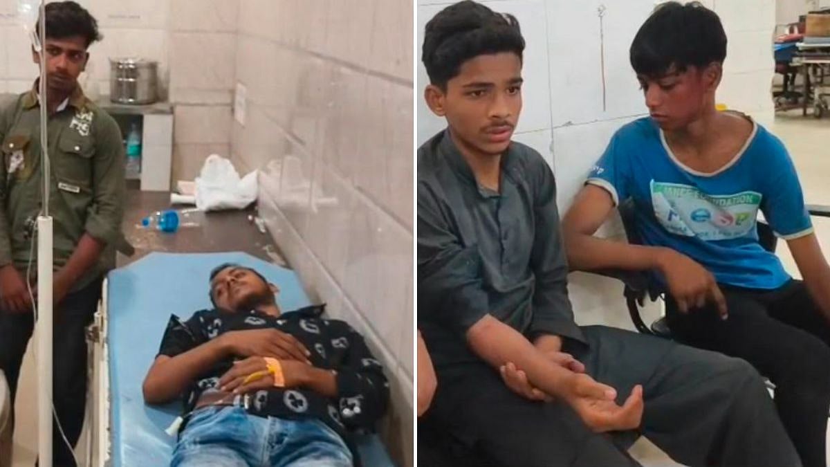 Four Minor Boys Brutally Assaulted With Iron Rods In Bhiwandi For Plucking Raw Mangoes, One Leg Fractured