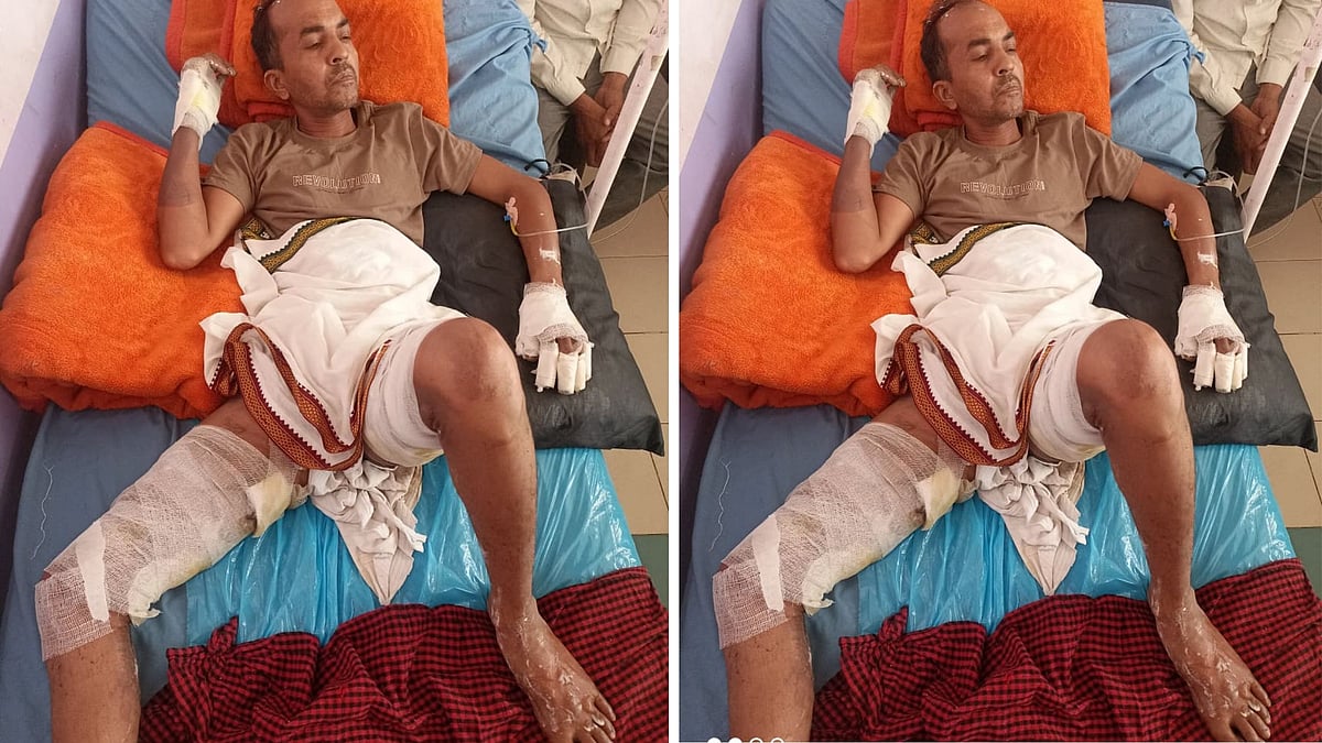 3 Held For Setting The Shopkeeper On Fire For ₹5 Pepsi In Sonkatch