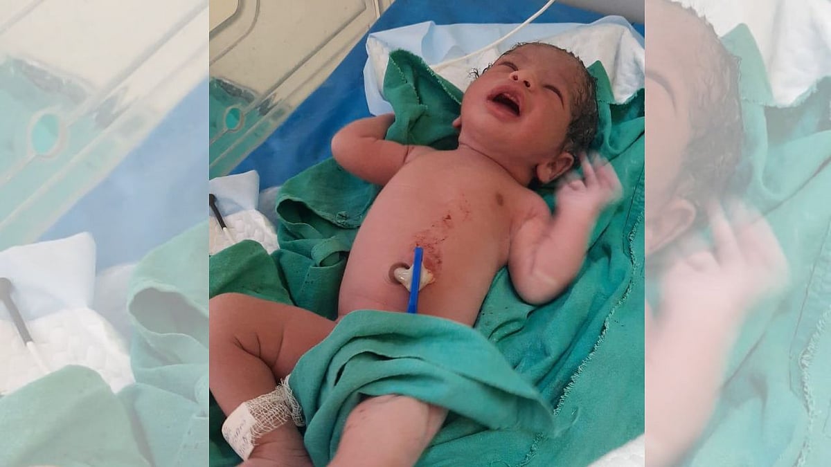 Doctors Save 37-Year-Old Mom, Baby In Rare High-Risk Twin Delivery In Indore