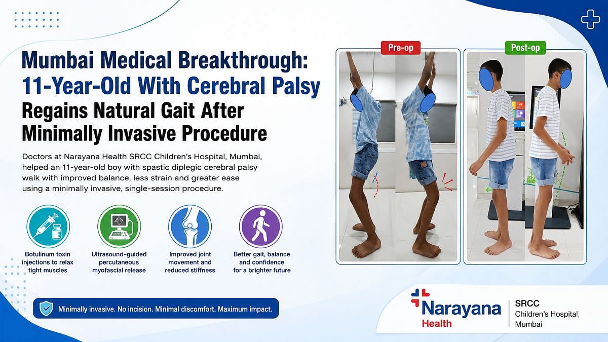 Mumbai Medical Breakthrough: 11-Year-Old With Cerebral Palsy Regains Natural Gait After Minimally Invasive Procedure At Narayana Health SRCC Hospital