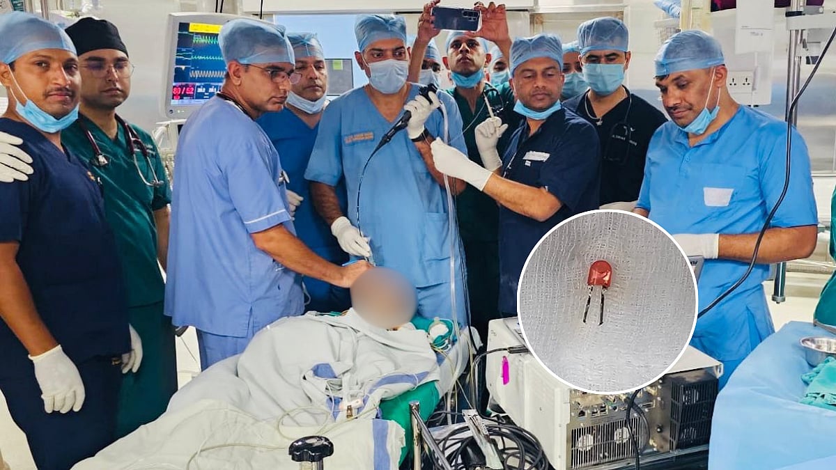 Doctors At Pune Army Institute Save 9-Month-Old Infant After Removing Hazardous LED Bulb Stuck Inside Lung